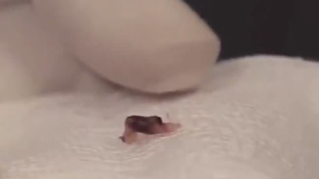 Alien implants in humans What is the purpose? 1 06942761 2