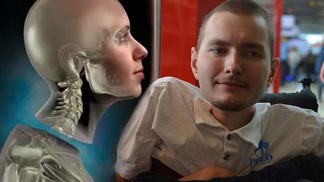 The first transplant of Head of History already has date: December of 2017