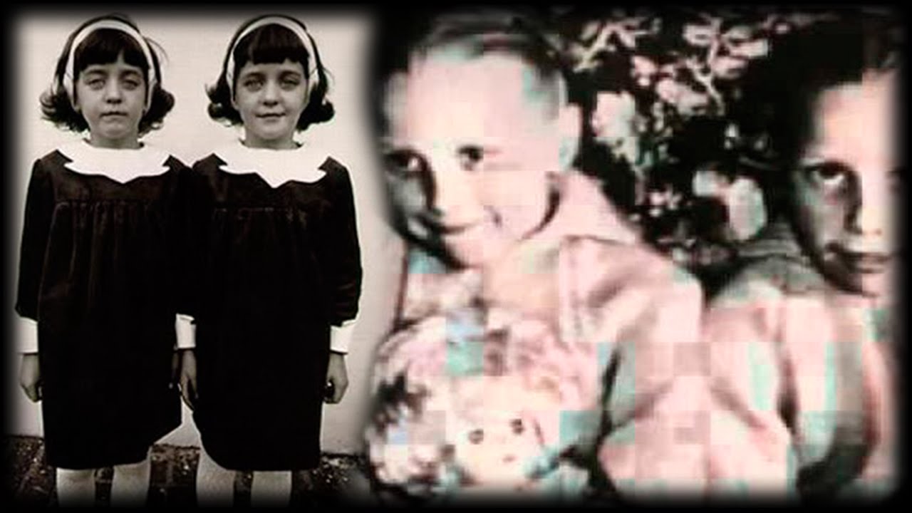 The Mystery of the Pollock Twins, a case of Reincarnation documented by Scientists