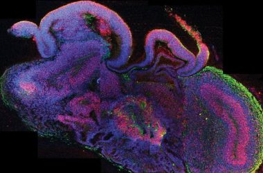 transversal cerebro lab