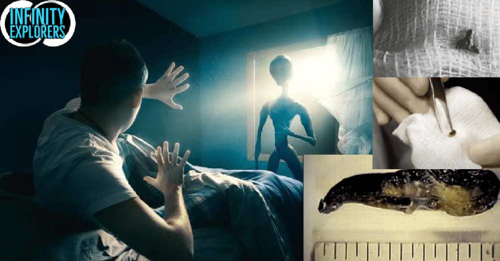 Surgeon Roger Leir And His Study Of Mysterious Alien Implants