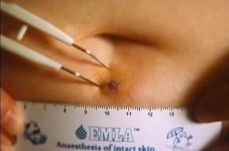 The Mysterious Alien Abduction Case Kelly Cahill An Australian Woman 2 Kelly Cahill
