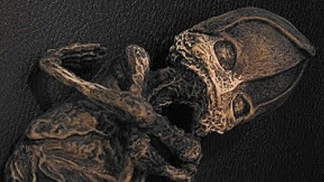 Alyoshenka, The Kyshtym Dwarf: Was It Really An Alien From Outer Space?? 2 Alyoshenka, The Kyshtym Dwarf: Was It Really An Alien From Outer Space??