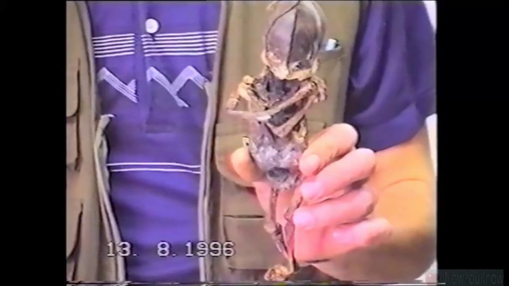 Alyoshenka, The Kyshtym Dwarf: Was It Really An Alien From Outer Space?? 6 maxresdefault