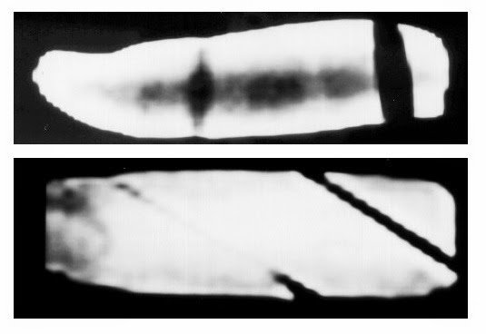 The Mystery Of The 100 Million Years Old Fossilized Human Finger