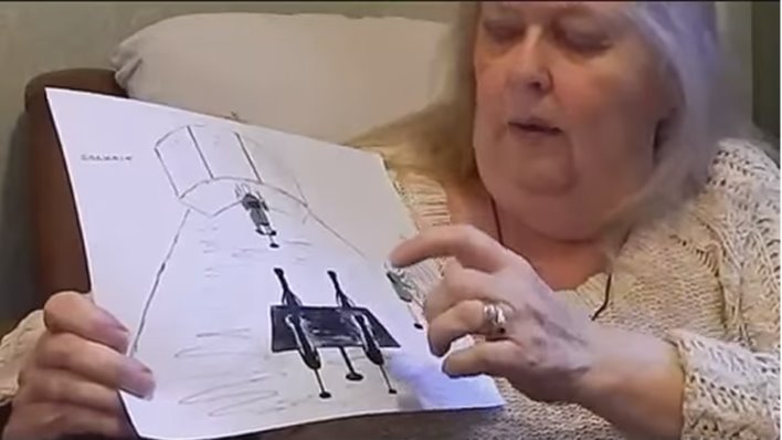 The Alien Abduction Of Hilary Porter: Repeated Abductions By Gray Aliens, Bruises And Implants