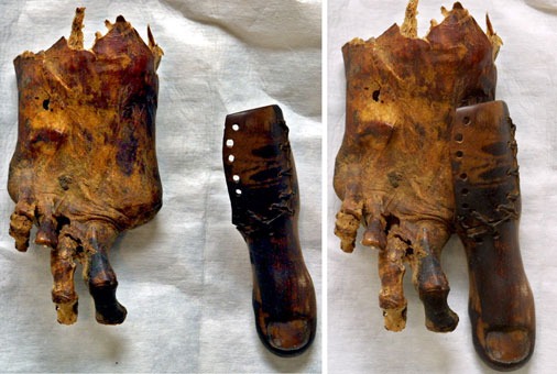 Ebers Papyrus: An Ancient Egyptian Text Reveals Fascinating Advanced Medical Treatments 7 cairo toe