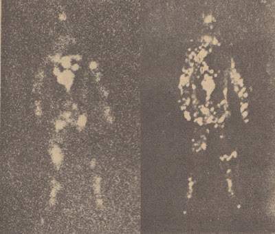 The Alien Encounter Of Police Chief Greenhaw: Managed To Photograph The Alien Being 6 The Alien Encounter Of Police Chief Greenhaw: Managed To Photograph The Alien Being