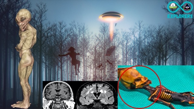 Stanford Professor Garry Nolan Stated “People Abducted By Aliens Share Common Symptoms”