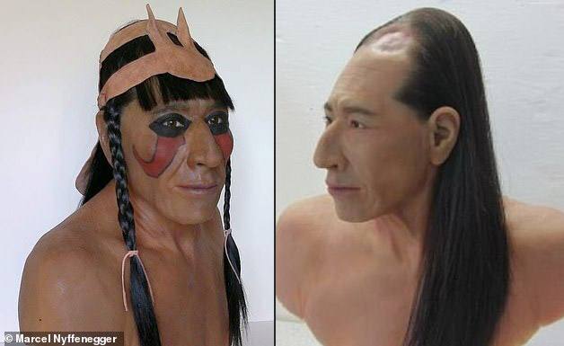 Advanced Surgery In Ancient Times: 2000 Year Old Elongated Skull Joined By Metal Found