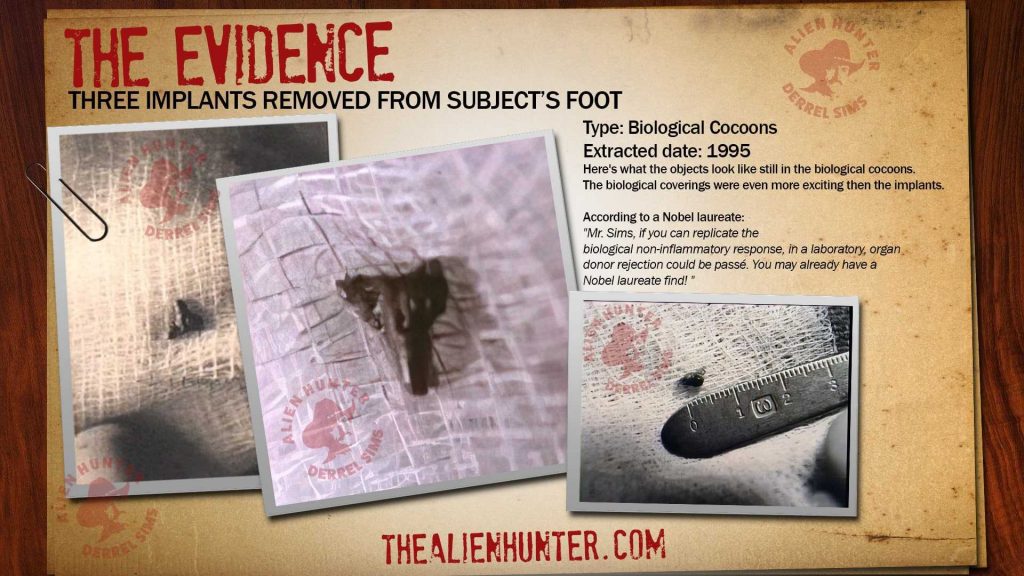 Former CIA Agent Derrel Sims: Admits To Possess Alien Implants Found Inside Alien Abduction Victims 3 1