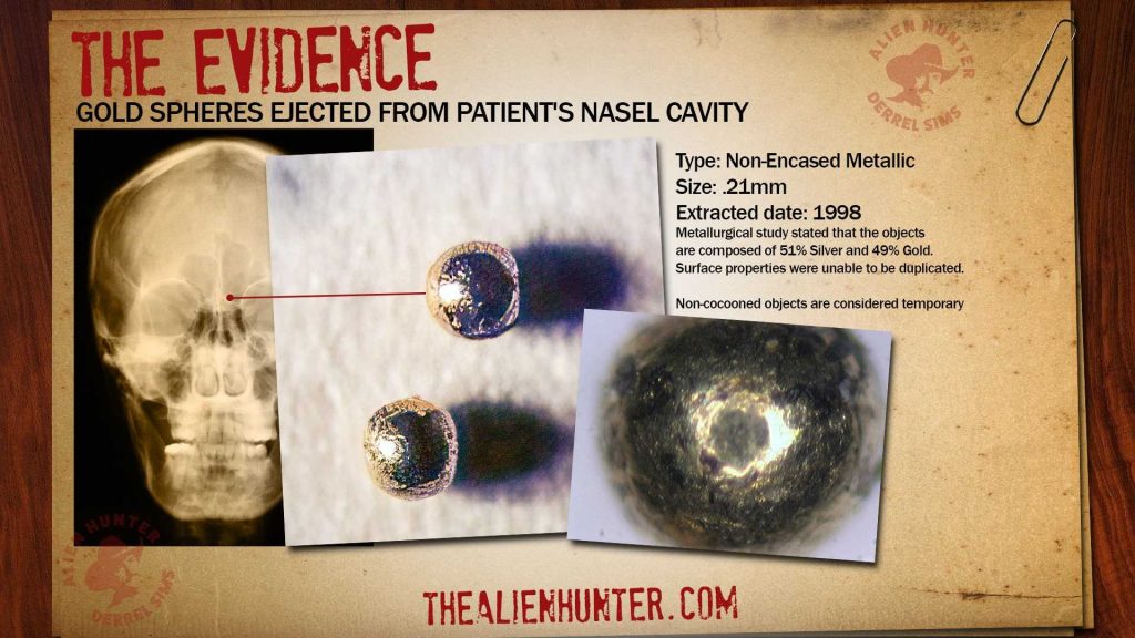 Former CIA Agent Derrel Sims: Admits To Possess Alien Implants Found Inside Alien Abduction Victims 4 6