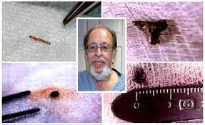 The Study Of Aliens Implants And It's Effects By Dr. Roger Leir 3 Alien Implants