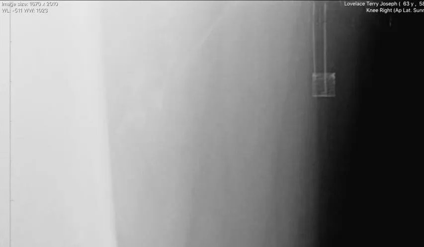 The Alien Abduction Of Terry Lovelace