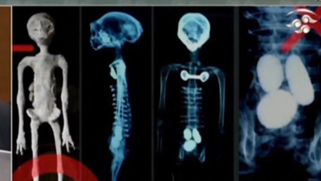 X-ray of alien bodies revealed at public UFO hearing in Mexico