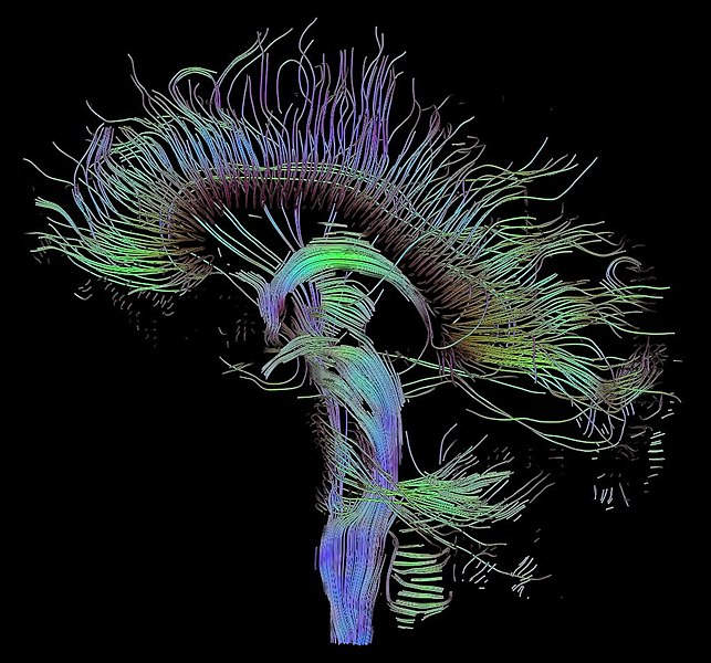 Transhumanism: Can We Upload Our Minds To a Computer?